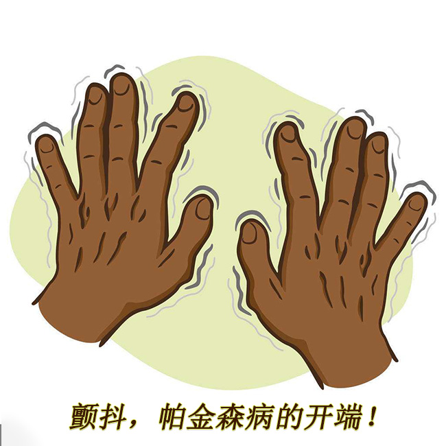 顫抖，帕金森病的開端 帕金森的早期癥狀